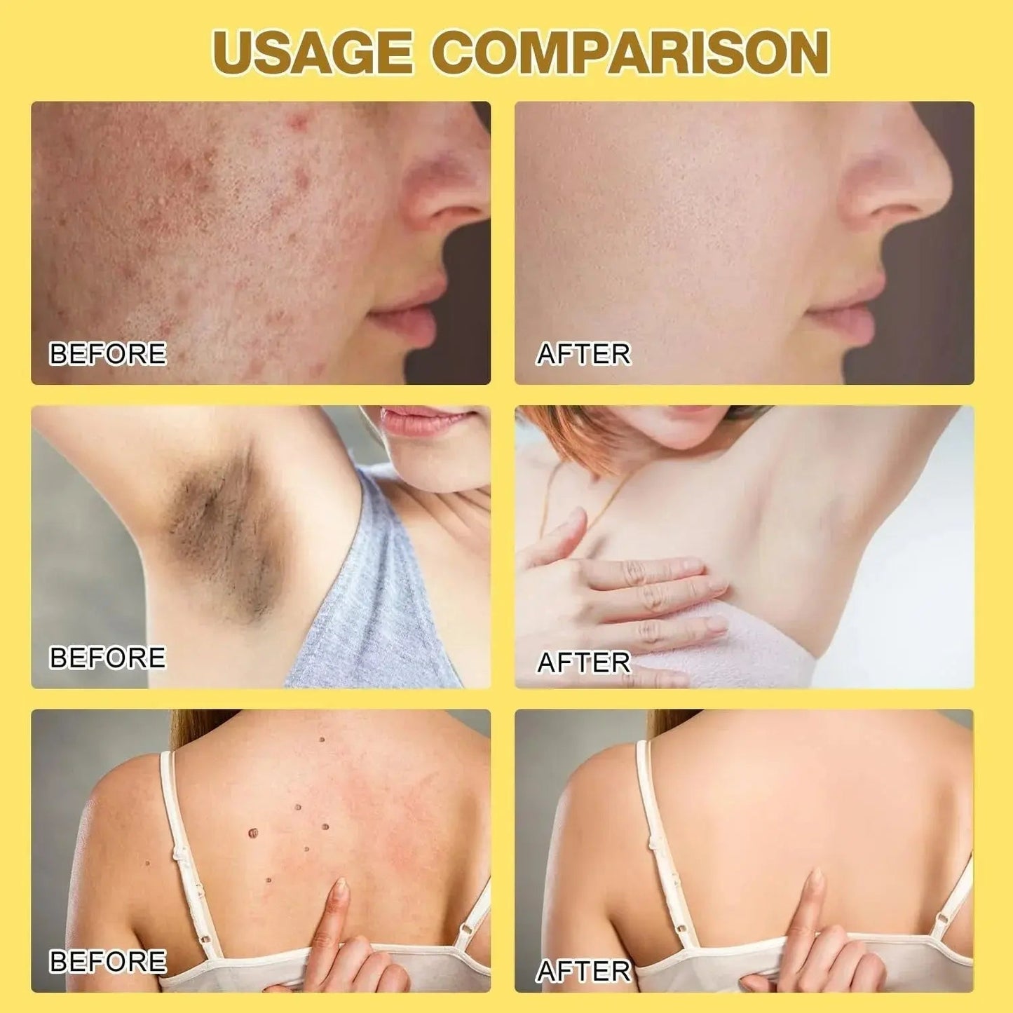 Bee Venom Skin Treatment Cream