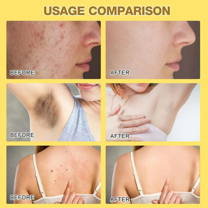Bee Venom Skin Treatment Cream