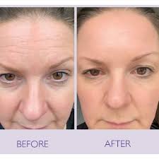 Retinal Shot Tightening Booster-💯 ORIGNAL Buy 1 Get 1 Free ✨